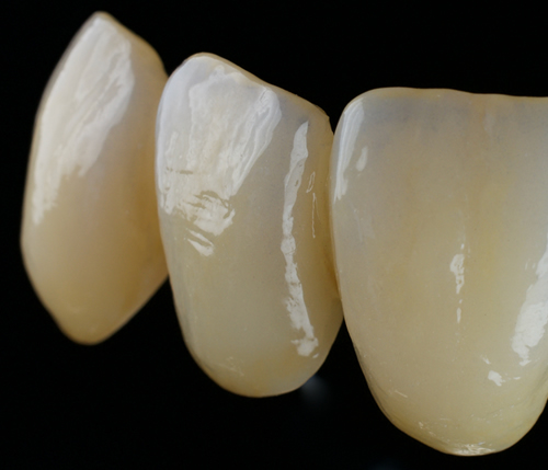 DENTAL MAKYAJ EĞİTİMİ